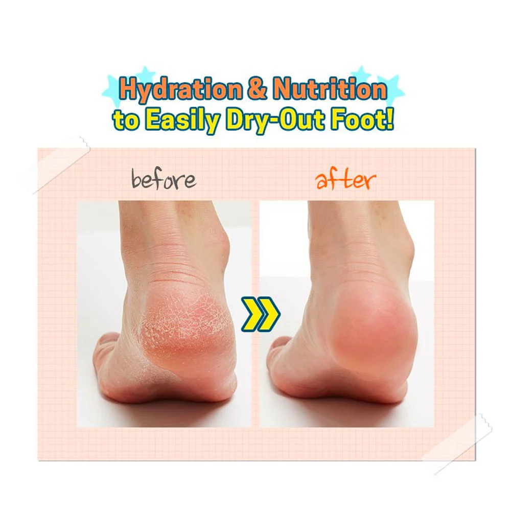 Chaussettes exfoliantes A'pieu Soft Foot 30 minutes