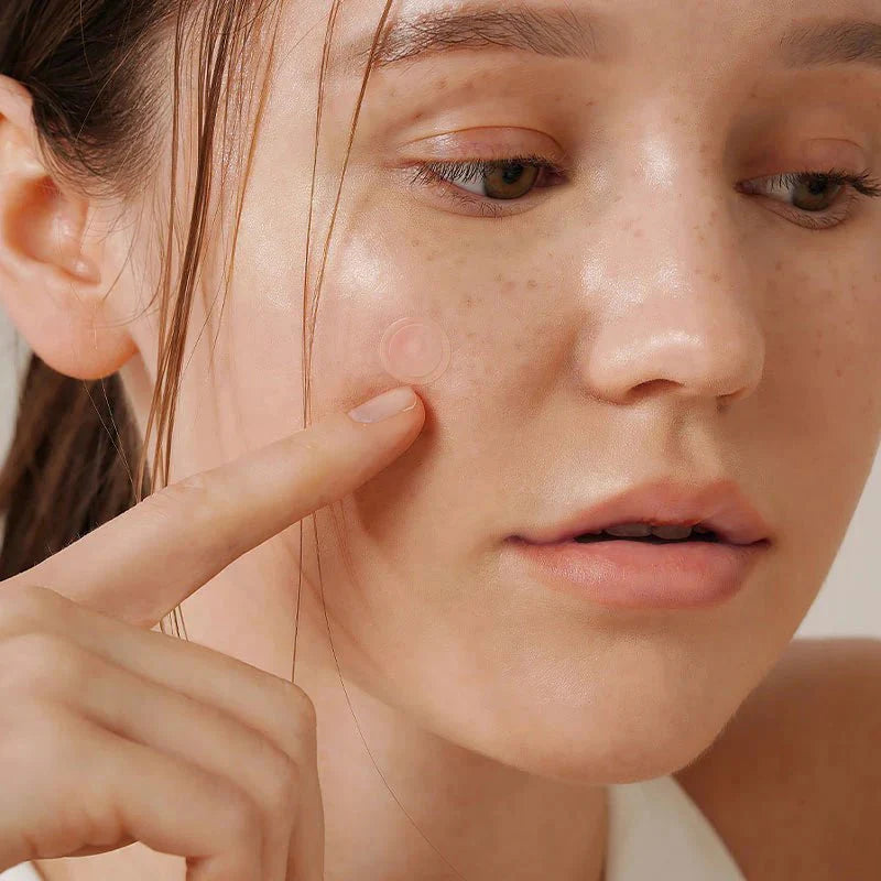 Isntree Onion Newpair Spot Patch