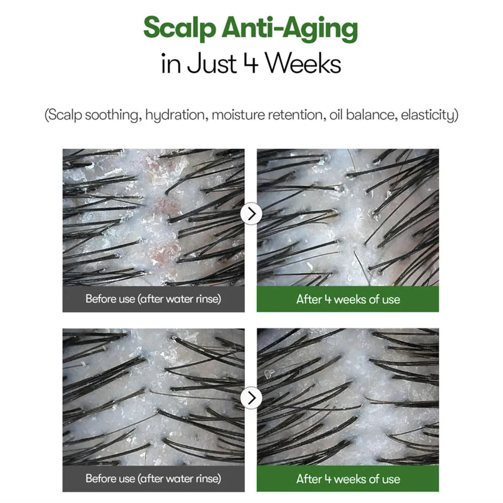 VT Cosmetics  Reedle Shot Hair Ampoule 100 15ml